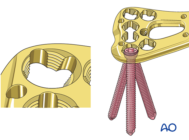 Polyaxial screws