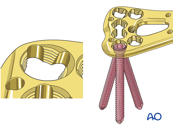 Locking head screw insertion