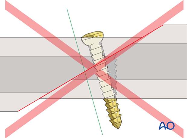 Screw inserted outside screw axis