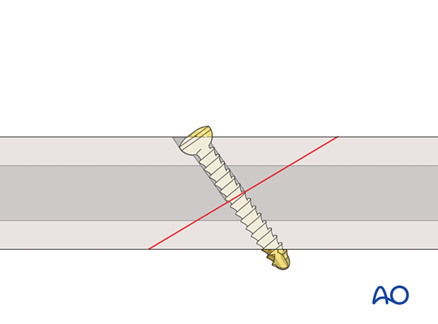 Self-tapping screw inserted