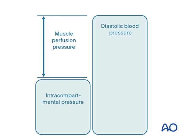 Muscle perfusion pressure, intracompartmental pressure, and diastolic blood pressure