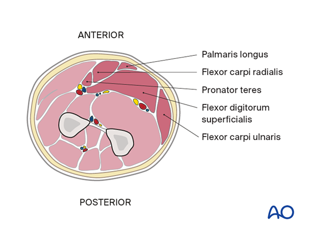 Mid forearm - superficial flexor compartment