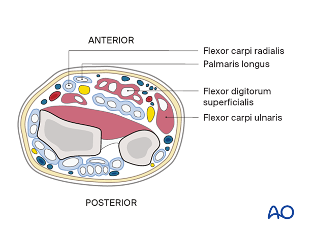 Distal forearm - superficial flexor compartment