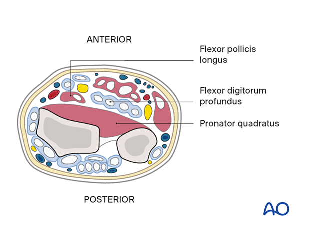 Distal forearm - deep flexor compartment (pronator quadratus)