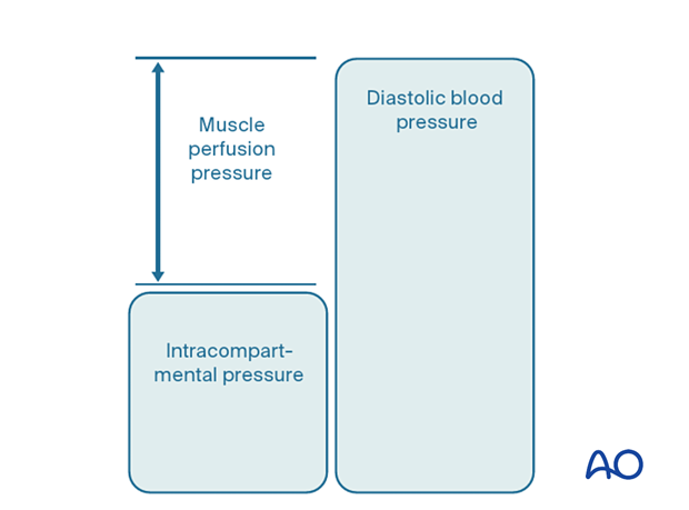 Compartment syndrome: intracompartmental pressure, muscle perfusion pressure, and diastolic blood pressure