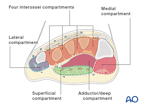 Compartment syndrome in the foot – compartmental anatomy