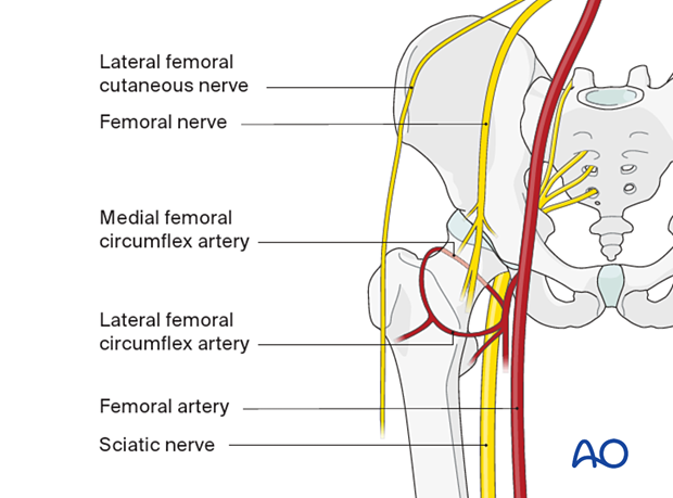 60 X010 Compartment syndrome gluteal