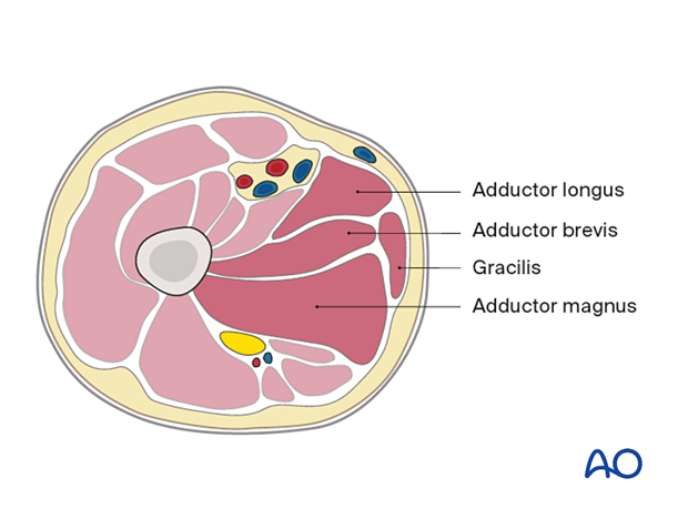 Proximal femur – medial compartment