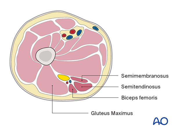 Proximal femur – posterior compartment