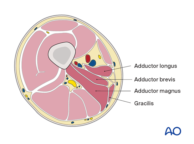 Mid femur – medial compartment