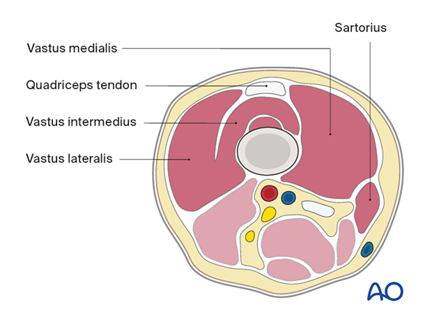 Distal femur – anterior compartment
