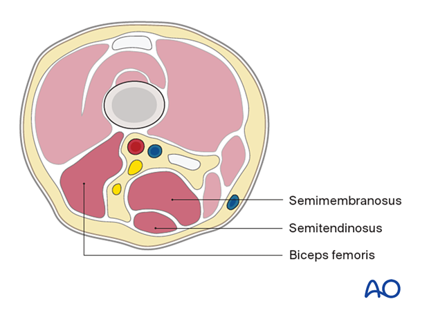 Distal femur – posterior compartment 