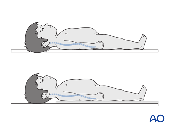 pediatric polytrauma