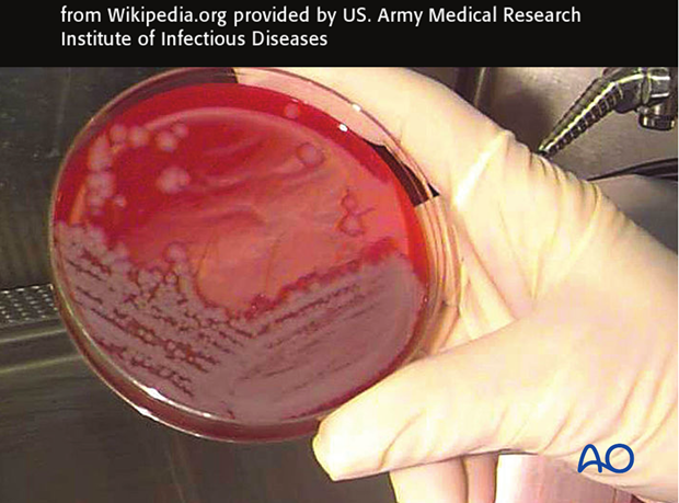 Methicillin-resistant Staphylococcus aureus - Wikipedia