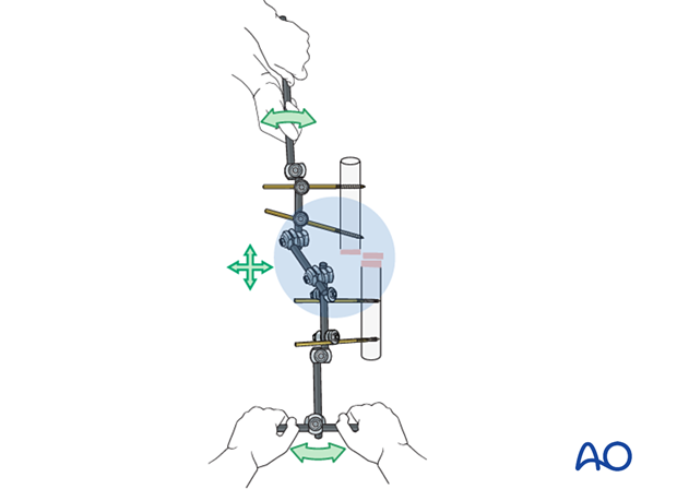 Rods added to partial frames to lengthen lever arm and aid reduction