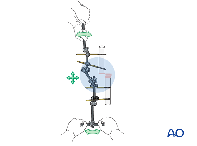 Modular external fixation