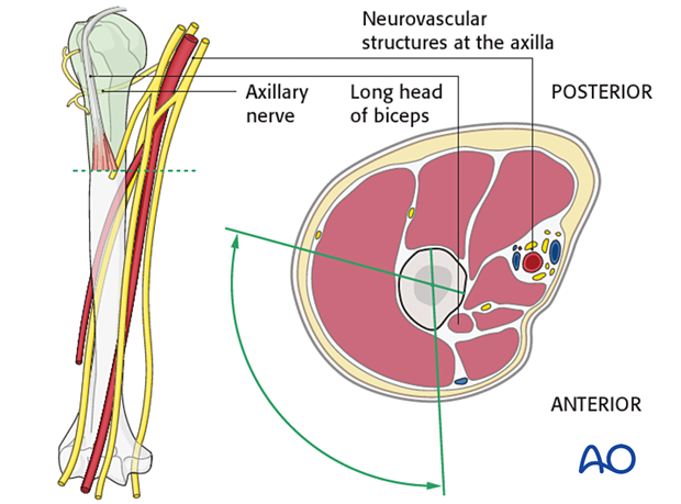 11_A10_i100 mio screw fixation