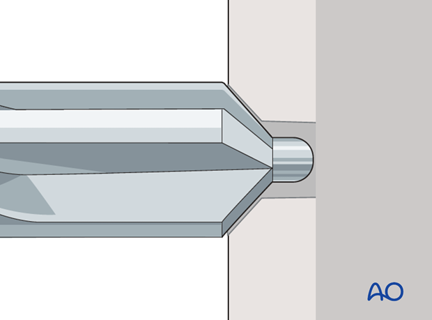 11_C30_i460 nailing straight nail