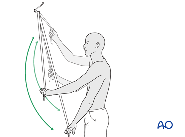 A rope and pulley assembly. With the pulley placed above the patient, the unaffected left arm can be used to provide full ...