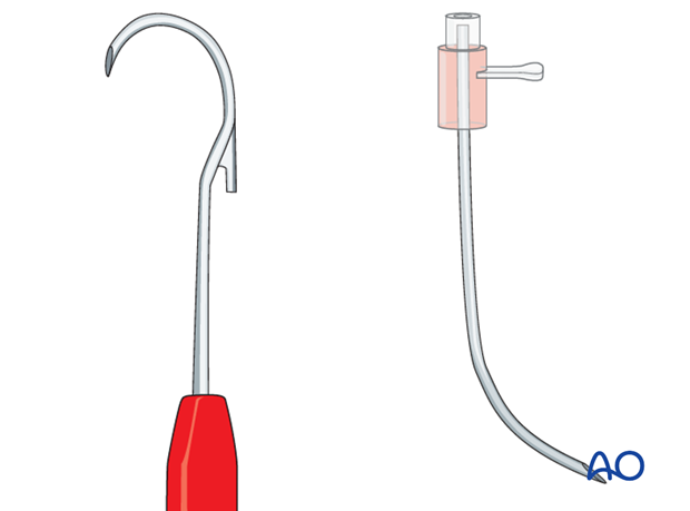 A standard catheter 14G can be bent in a hockey-stick shape and used as a cable passer.