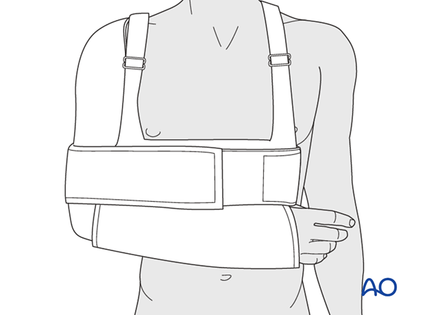 Secure injured arm