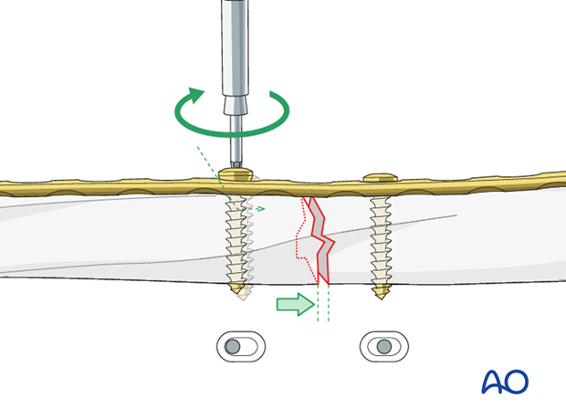 Dynamic compression principle