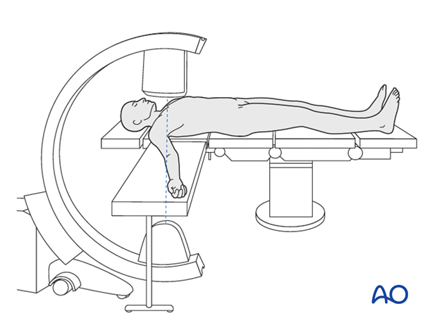 Supine position for casting