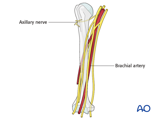 Neurovascular injuries