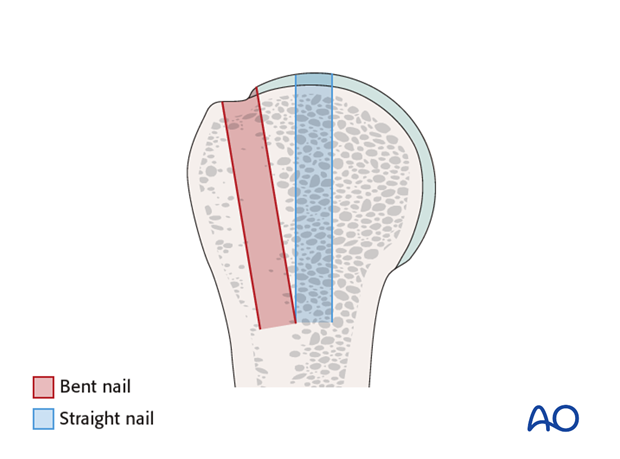 bent vs straight nails