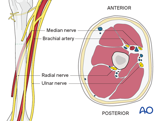 Neurovascular anatomy in the middle third of the humerus