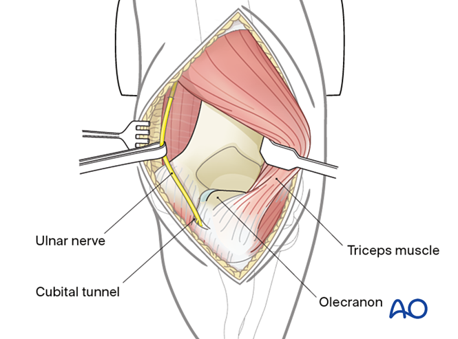 Gerwin Approach AO Trauma Course – Upper Extremity Trauma