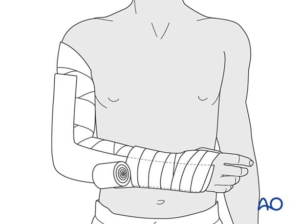 Secure the splint with an elastic bandage that should not be too tight.