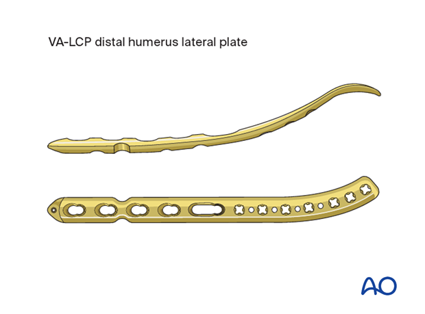 VA-LCP distal humerus lateral plate