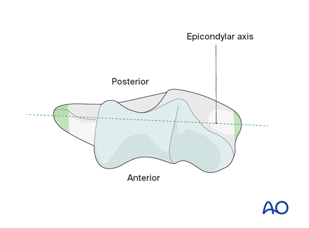 Epicondylar axis