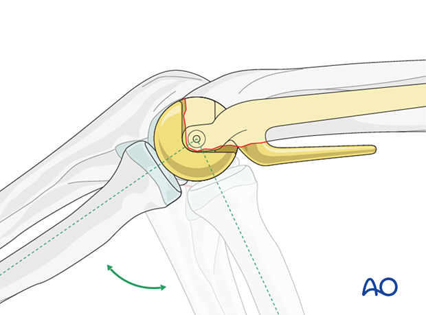 Applying varus, valgus, and rotational stresses to the joint throughout a full range of motion