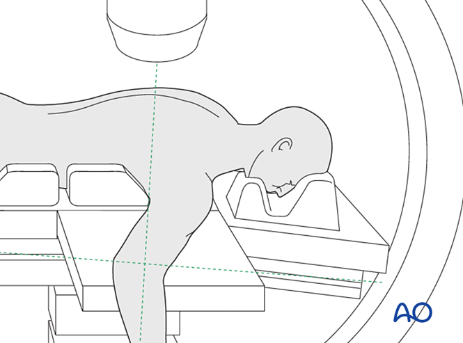 Prone Reference Image Prone position