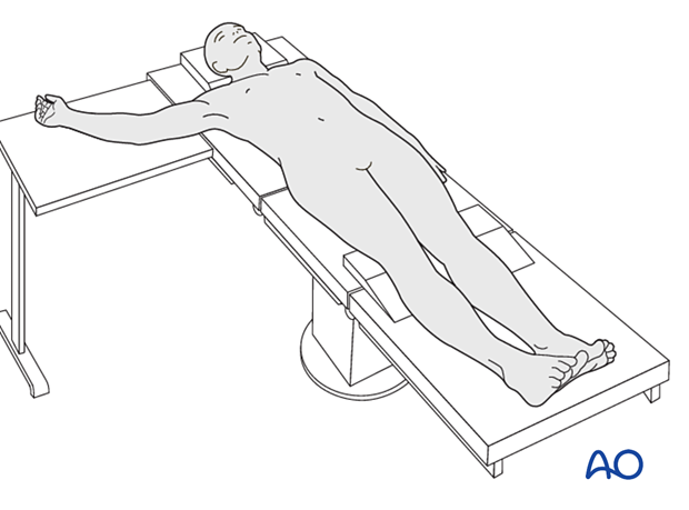 Arm position for medial approach