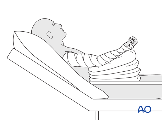 Semireclining patient position, with the elbow elevated, preferably above the chest, on pillows
