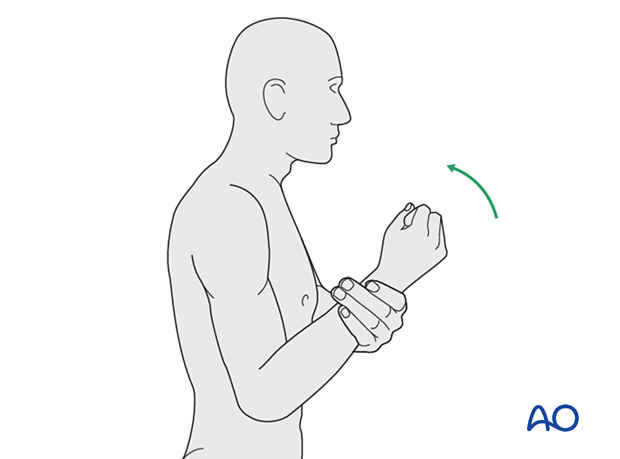 Gravity-eliminated active-assisted elbow motion exercises