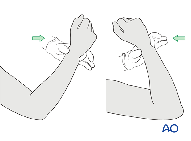 The elbow is gently mobilized to confirm restoration of motion.