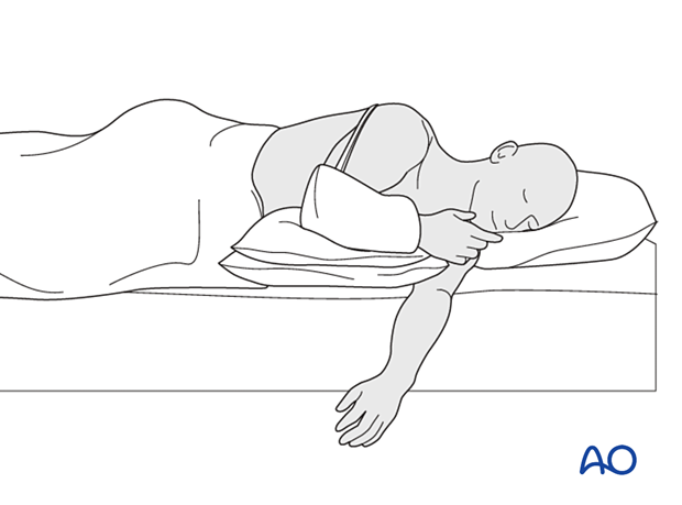 Можно ли спать на боку после операции. Поза сна при переломе плеча. Позы для сна при переломе ключицы. Позы для сна со сломанной рукой. Удобное положение для сна при переломе плеча.