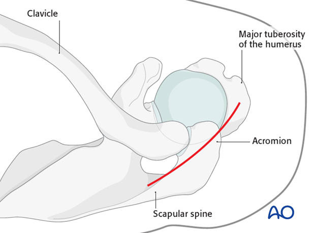 Skin incision