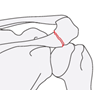 scapula