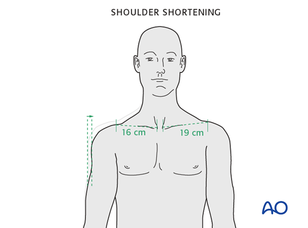 clinical and radiological examination of patients with clavicle injuries