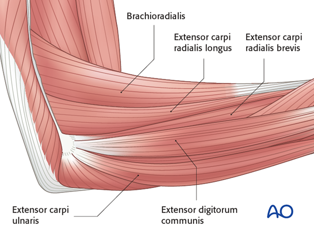 Lateral approach to proximal forearm – Kaplan interval