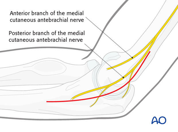 Repair of medial collateral ligament - Exposure