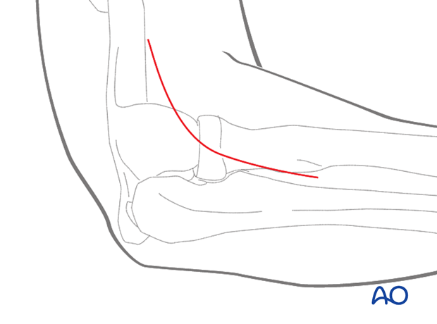 lateral approach to the proximal radius