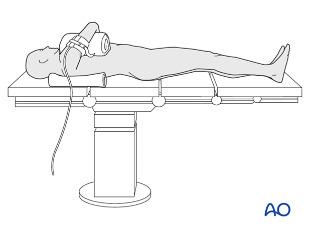 supine for posterior access