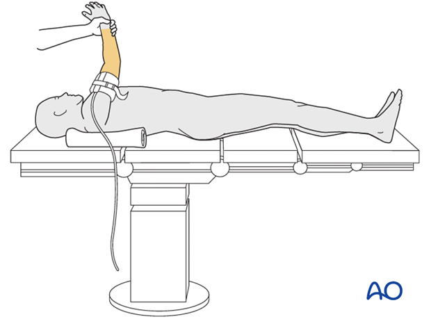 supine for posterior access