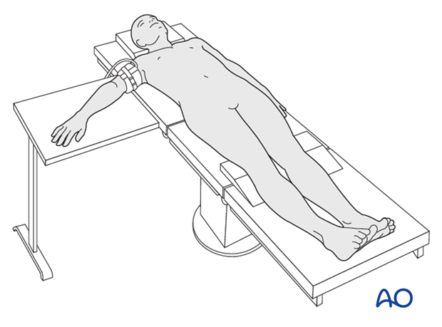 Supine for lateral access